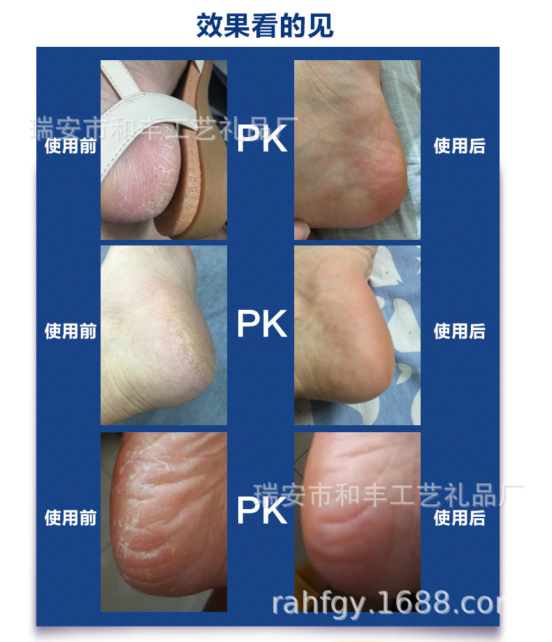 Wholesale foot care devices, electric foot scrubs for removing dead skin and keratin, household electric foot scrubs, one-piece consignment pic 10