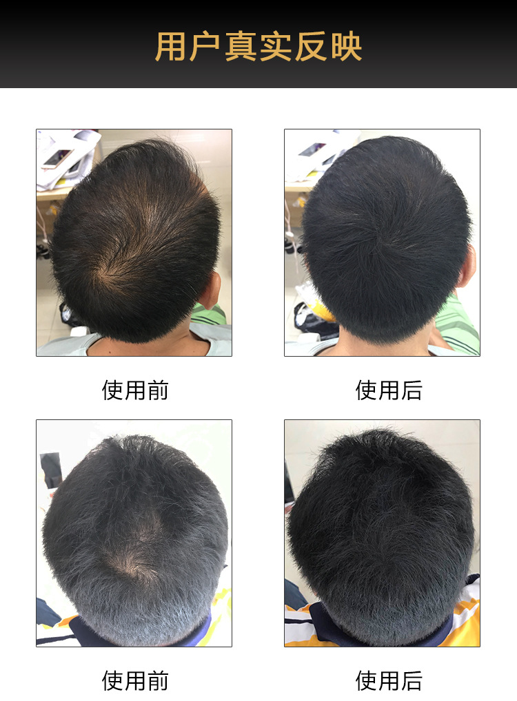 Disposable fiber hair replacement spray, hair density spray, popular black hair thinning, hair density spray manufacturer wholesale pic 9