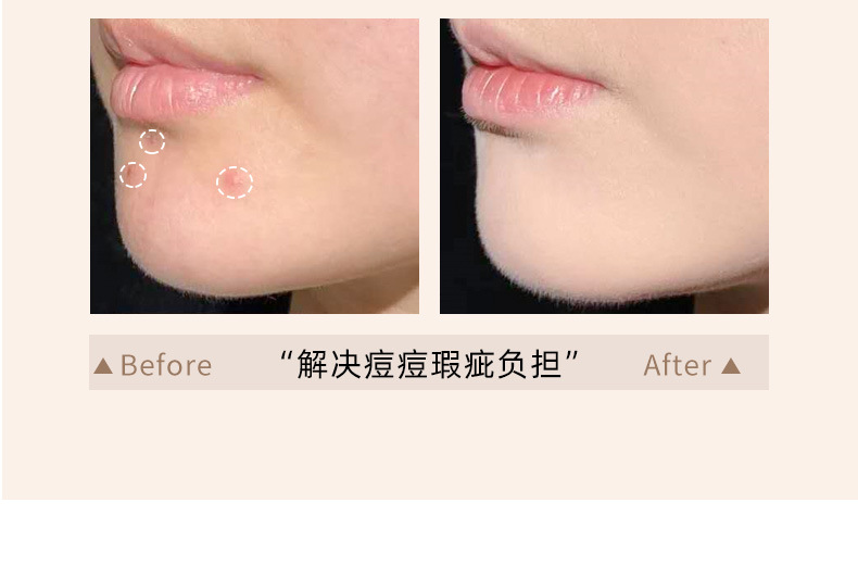 xixi Hydrating and Repairing Foundation for Dry Skin, Women, Concealer, Moisturizing, Waterproof, Sweat-proof, Long-lasting and non-smudging Foundation Cream pic 9