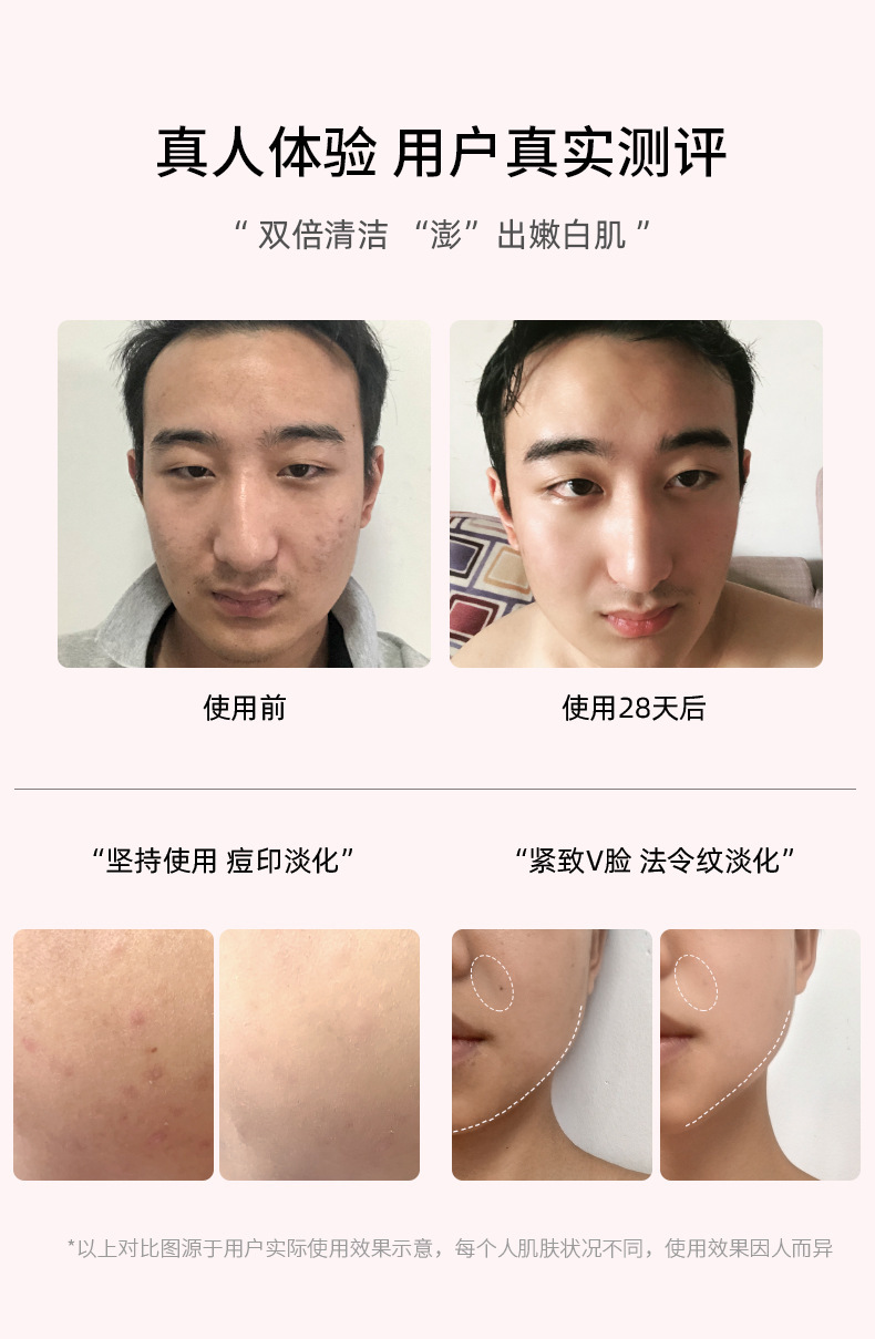 shanilak  脸部发热导入美容仪面部提拉紧致震动按摩精华导入美容仪家用充电详情15