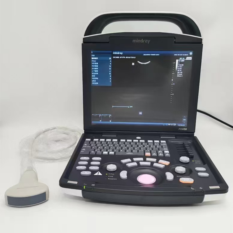 邁瑞醫(yī)用B超機DP-10全數(shù)字便捷式黑白超聲診斷系統(tǒng)搭配腹部探頭詳情12