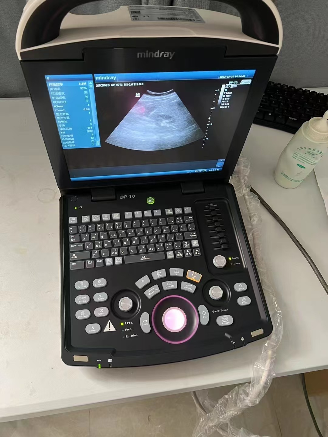 邁瑞醫(yī)用B超機DP-10全數(shù)字便捷式黑白超聲診斷系統(tǒng)搭配腹部探頭詳情9