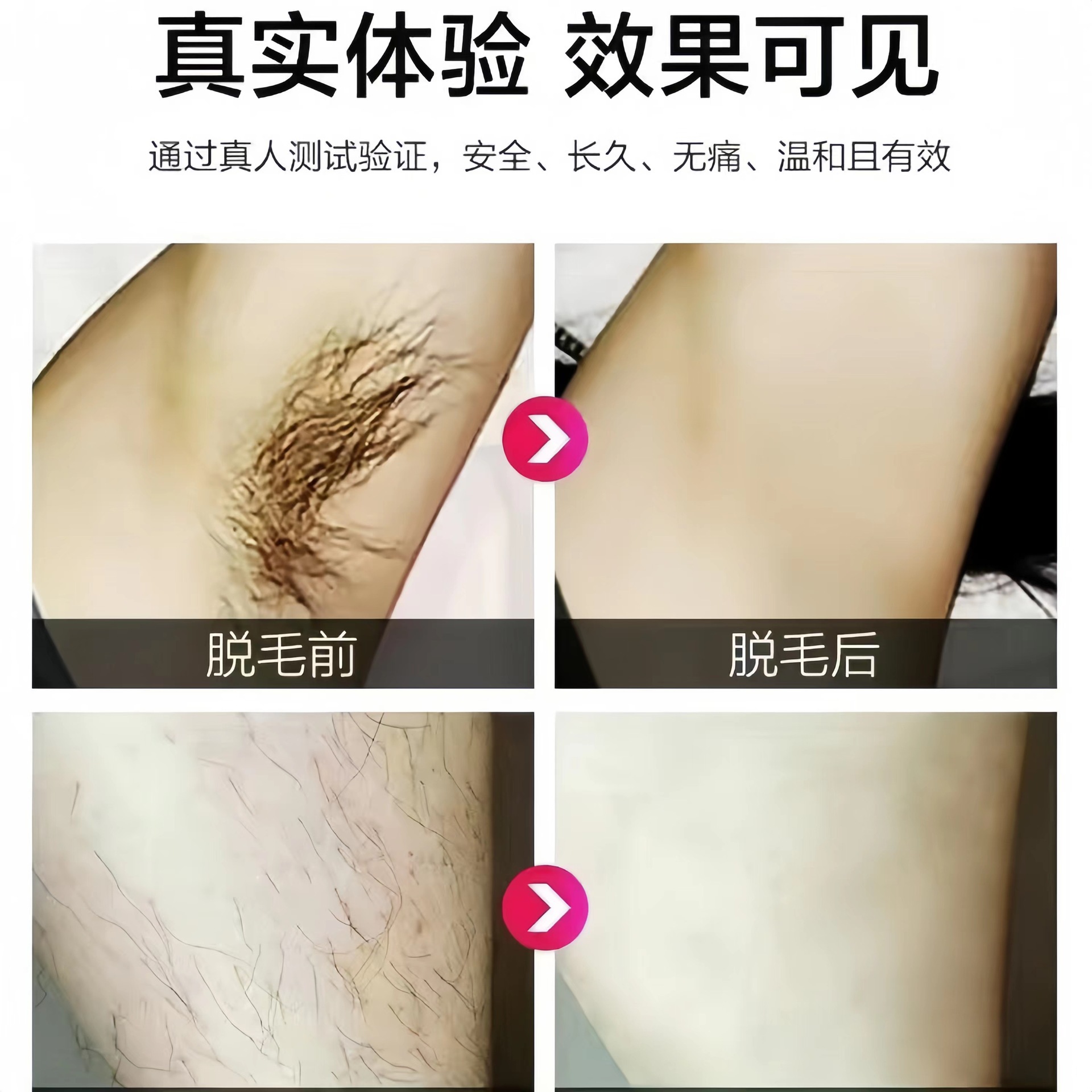 外贸爆款881家用电器男女通用脱毛仪器881面包脱毛仪工厂批发详情13