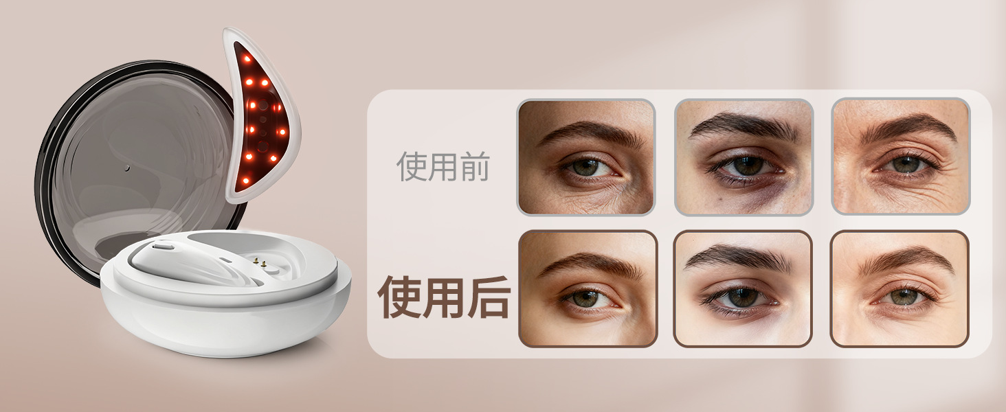 shanilak 跨境EMS美眼仪家用按摩抗皱黑眼圈护理眼袋红光微电流导入美容仪 pic 5