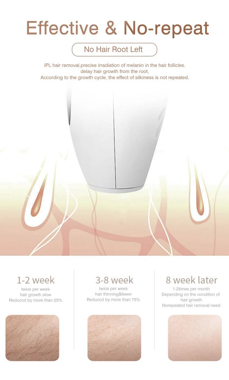 跨境手持激光脱毛仪女士光子嫩肤家用便携全身无痛不留黑脱毛仪器详情9