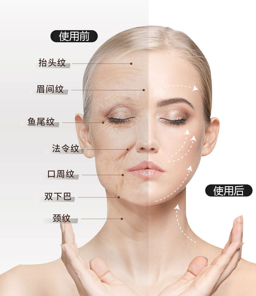 硅胶美容冰格面部按摩仪脸部按摩刮痧理疗工具详情5