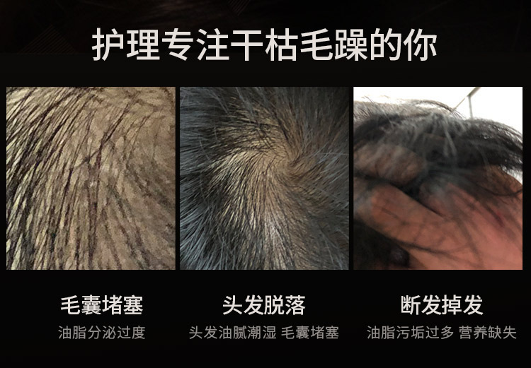 吹风机家用爆款负离子学生宿舍冷热风网红发廊电吹风筒厂家批发详情22