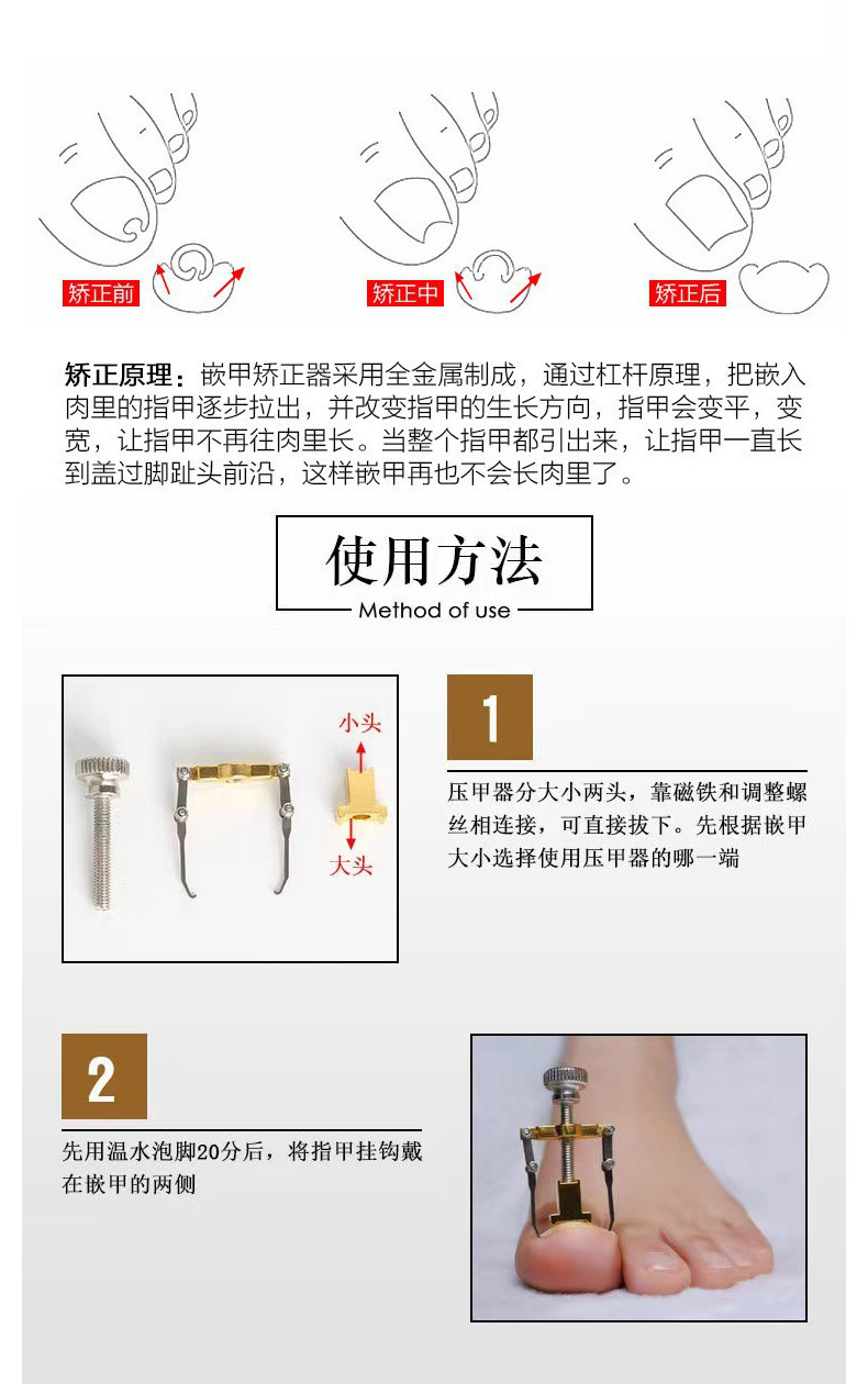 shanilak 跨境甲沟矫正器嵌甲矫正器脚趾甲卷指甲纠正神器正甲拉炎正甲贴片详情9