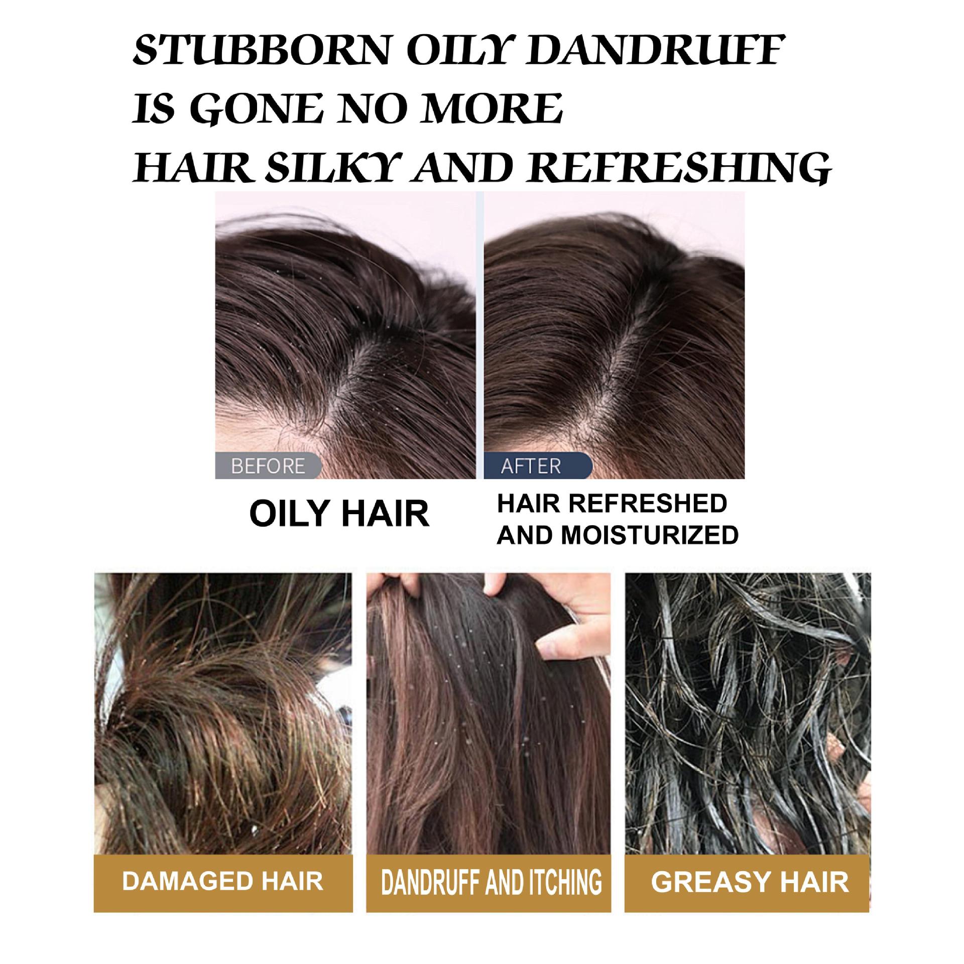 Anti-hair loss shampoo Anti-dandruff shampoo Deep Cleansing pic 8