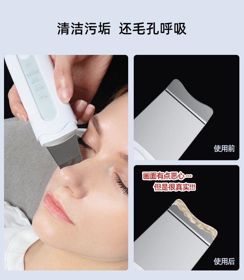 去黑头铲皮机脸面部毛孔清洁铲皮刀家用洁面导入出超声波美容仪器详情13