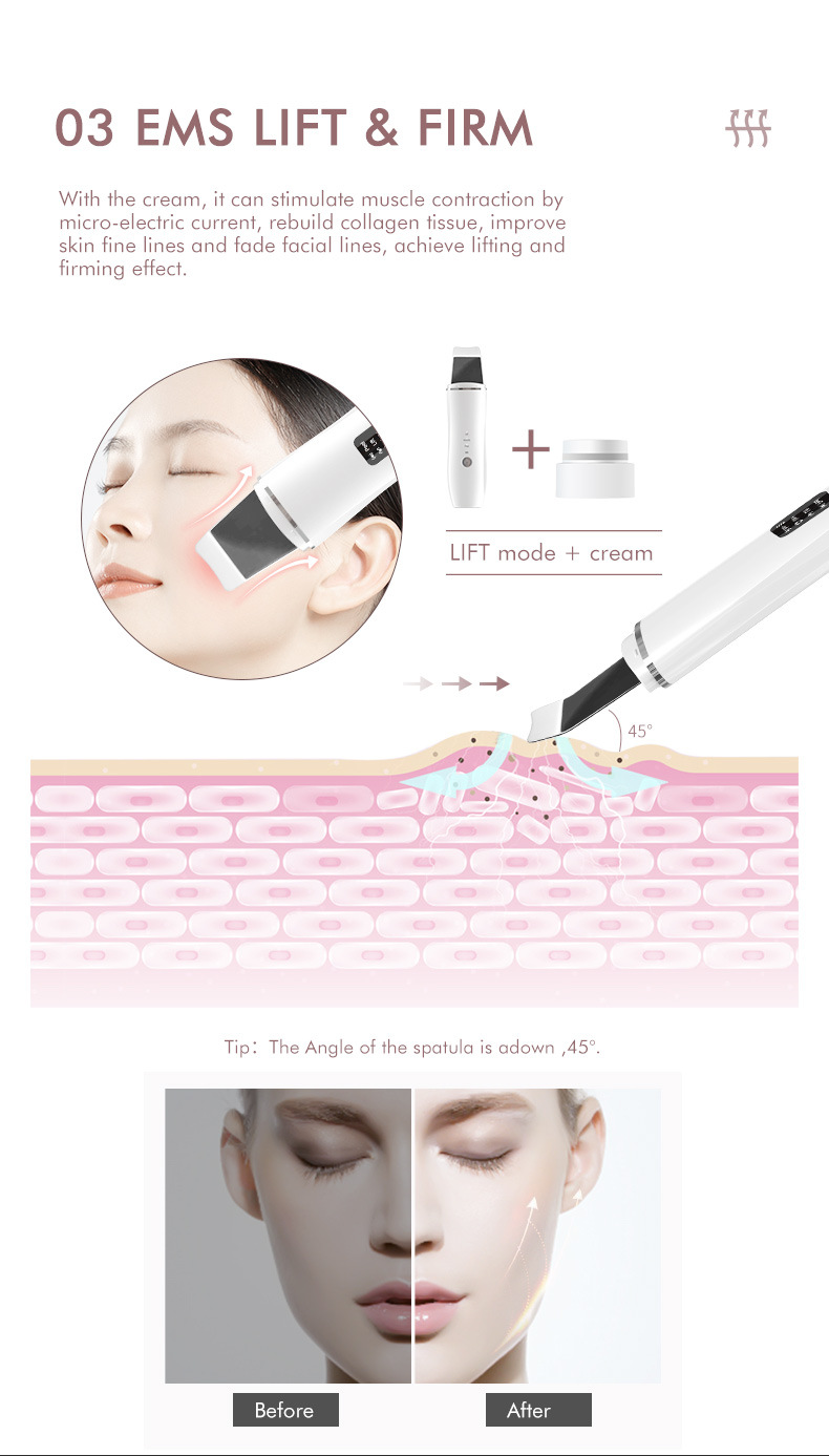 shanilak ultrasonic skin scraper facial cleansing and beauty device, blackhead removal facial cleansing device, skin scraper beauty introduction instrument pic 9
