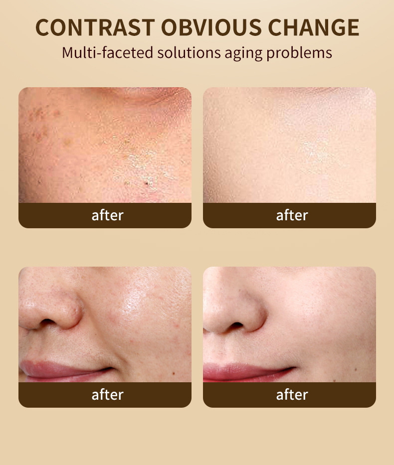 WWP跨境视黄醇面霜Whitening Cream滋润保湿抗皱紧致面霜50ml外贸详情11