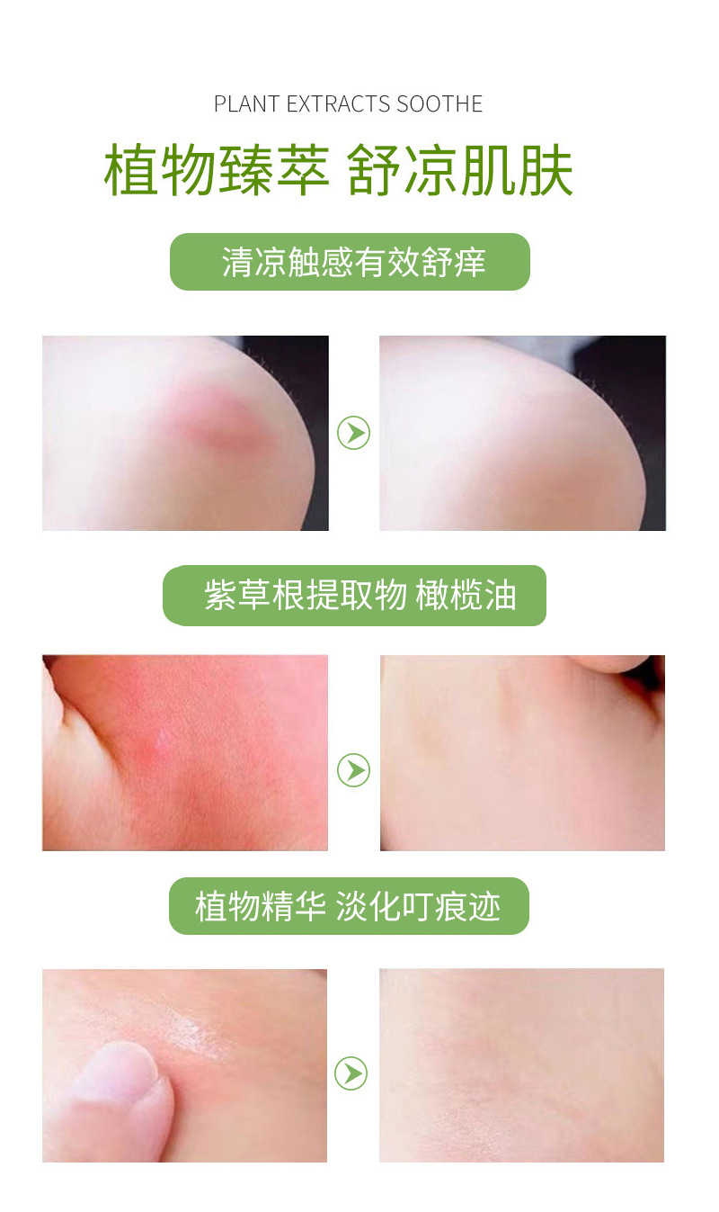 The three-stick Shijing Purple Grass Soothing Stick is suitable for children. It is made from herbal extracts and is safe, soothing, cooling and nourishing for outdoor travel pic 5