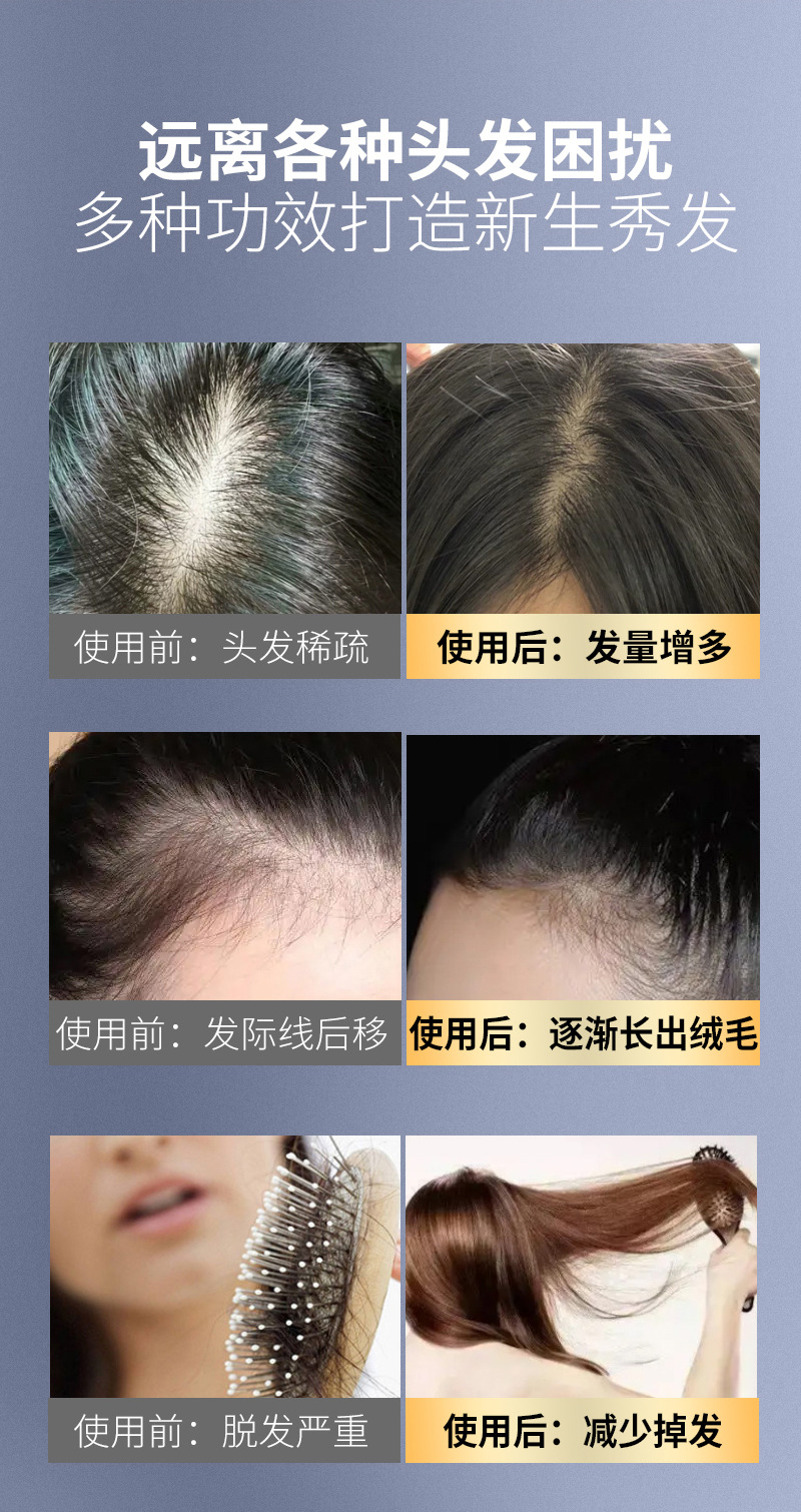 发功夫生姜洗发水防脱发固发育发正控油蓬松去屑洗头膏露男女详情8