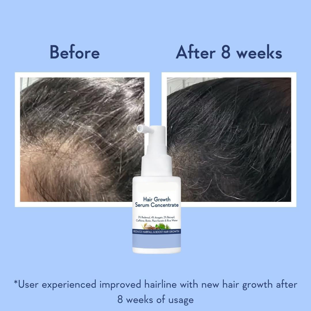 The new cross-border hair concentrate can improve frizzy hair, strengthen hair quality, care for damaged hair from dyeing and perming, cut hair, and control scalp oiliness pic 4
