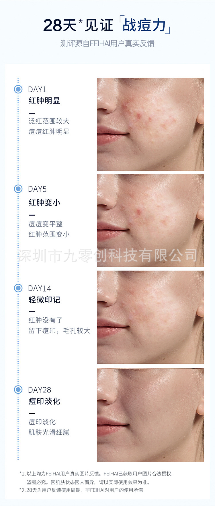 跨境电商换彩光子嫩肤七色多重光谱LED充电款448颗美容面罩灯具仪详情2