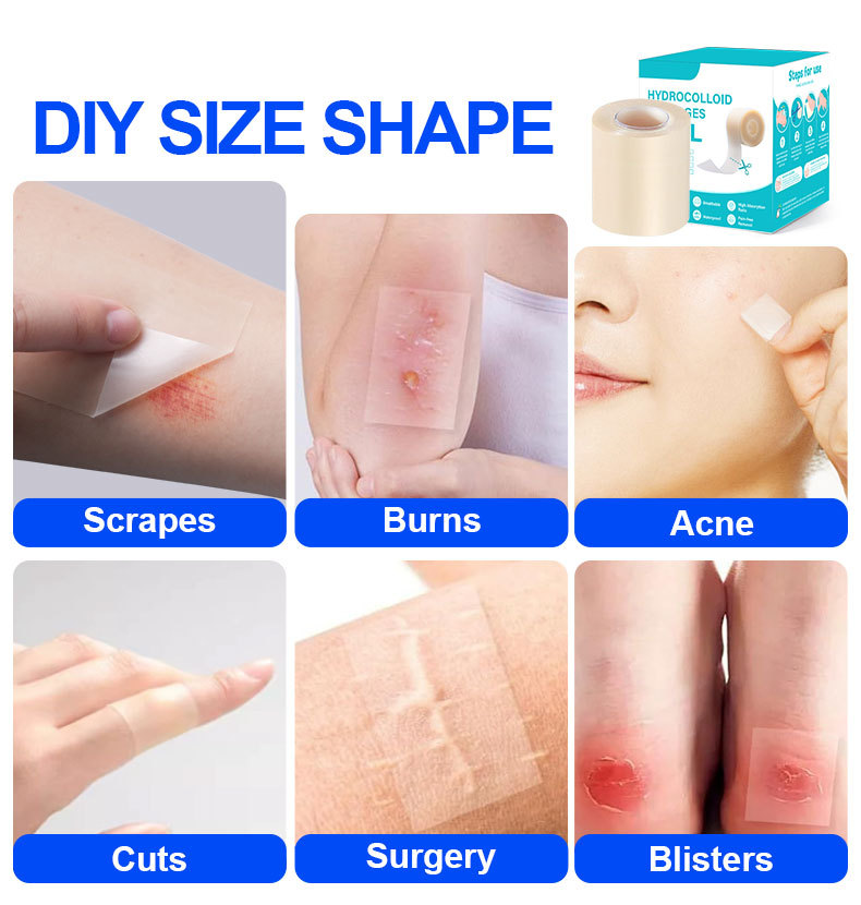 Amazon hydrocolloid roll wound dressing has strong water absorption. It is a hydrocolloid dressing for wet healing of superficial burns with liquid absorption pic 6
