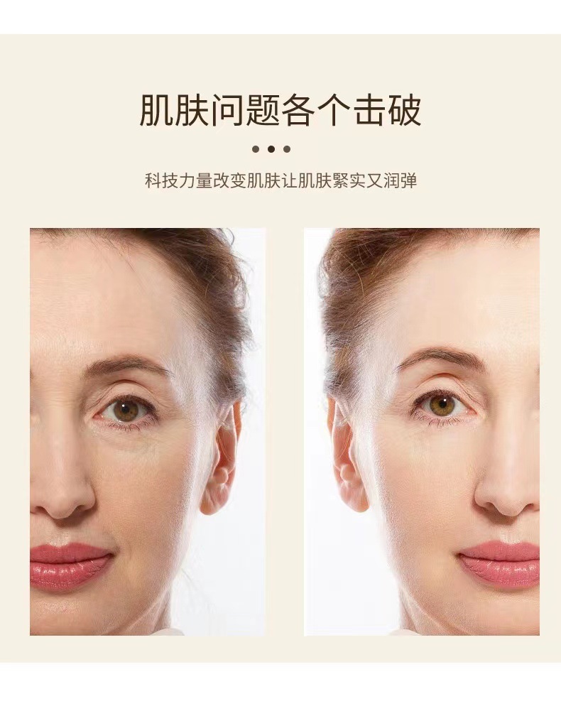 跨境迷你HIFU超声刀rf射频美容仪ems微电流面部提拉紧致按摩仪详情13