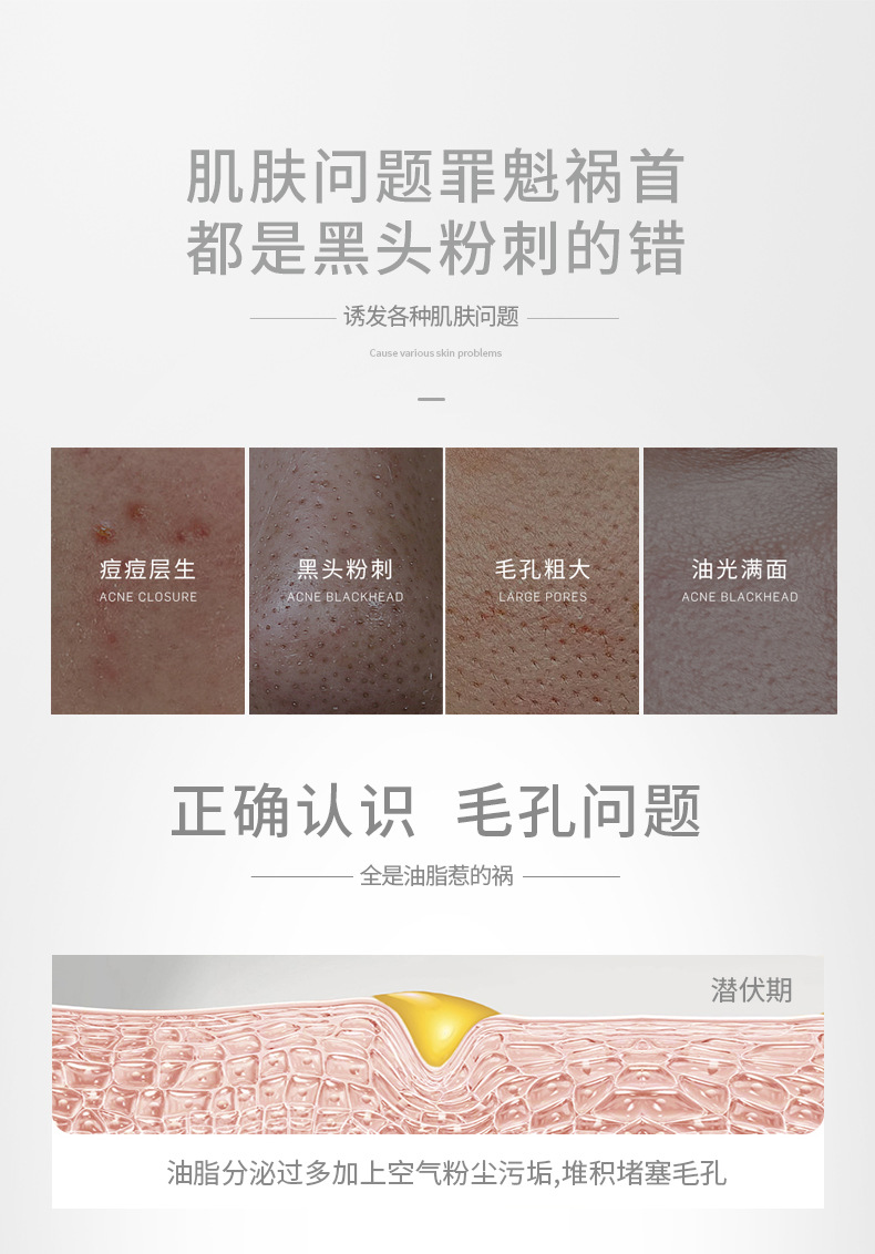 童兮黑竹炭净肤蛋蛋面纱霜去黑头粉刺角质T区护理鼻膜撕拉面膜详情4