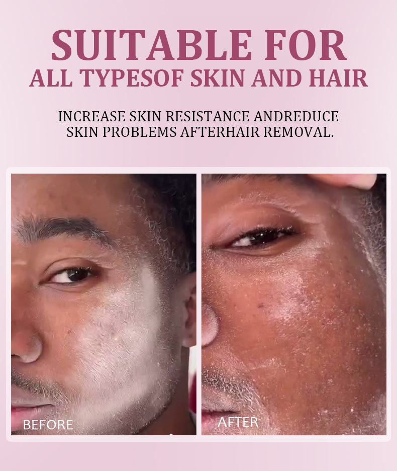 跨境专供FORMBO毛发识别喷雾配脱毛刀净肤清洁温和脱毛喷雾批发详情10