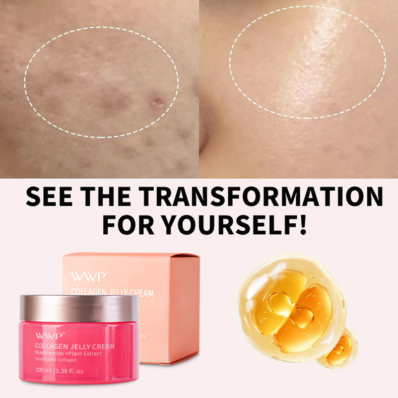 WWP跨境胶原蛋白果冻霜面霜凝胶补水高保湿滋润烟酰胺面膜亚马逊详情6