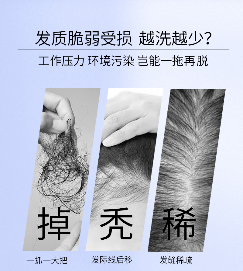 发功夫生姜洗发水防脱发固发育发正控油蓬松去屑洗头膏露男女详情2