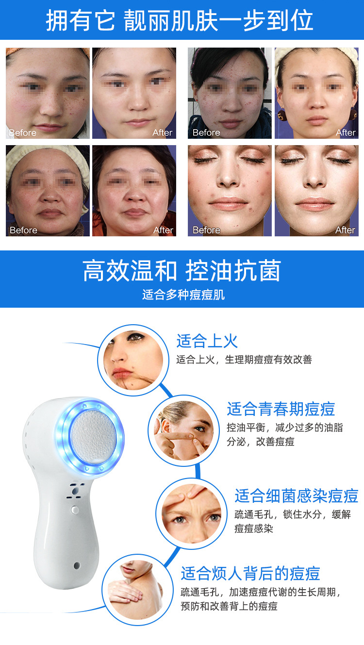 家用手持小冰锤冷敷仪蓝光冰敷导入仪美容院脸面部收缩毛孔舒缓详情3