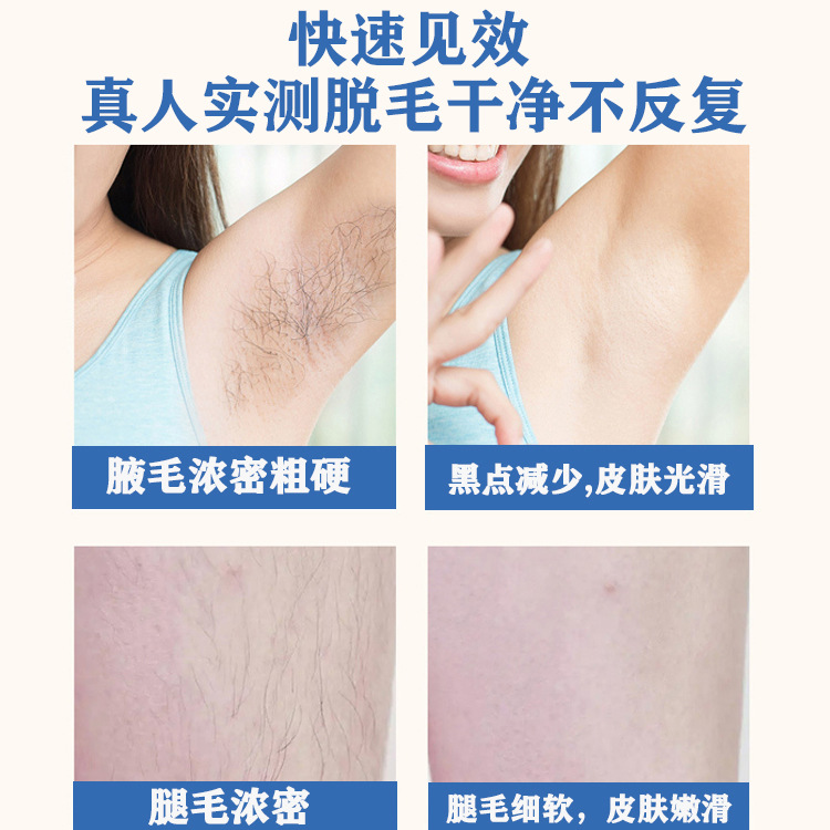 Cross-border bestseller with complete qualifications, small package laser hair removal device, home and hospital use full-body laser hair removal device pic 5