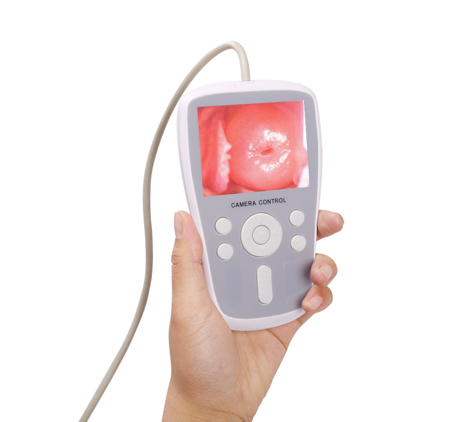 外贸专供便携式Portable Colposcope手持式推车详情12