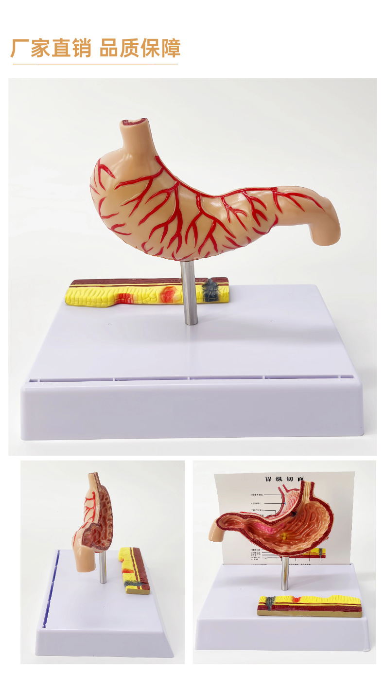 Human stomach anatomy model, traditional Chinese medicine teaching physical object, human stomach structure model, portable demonstration equipment, tuning fork to assist learning pic 10