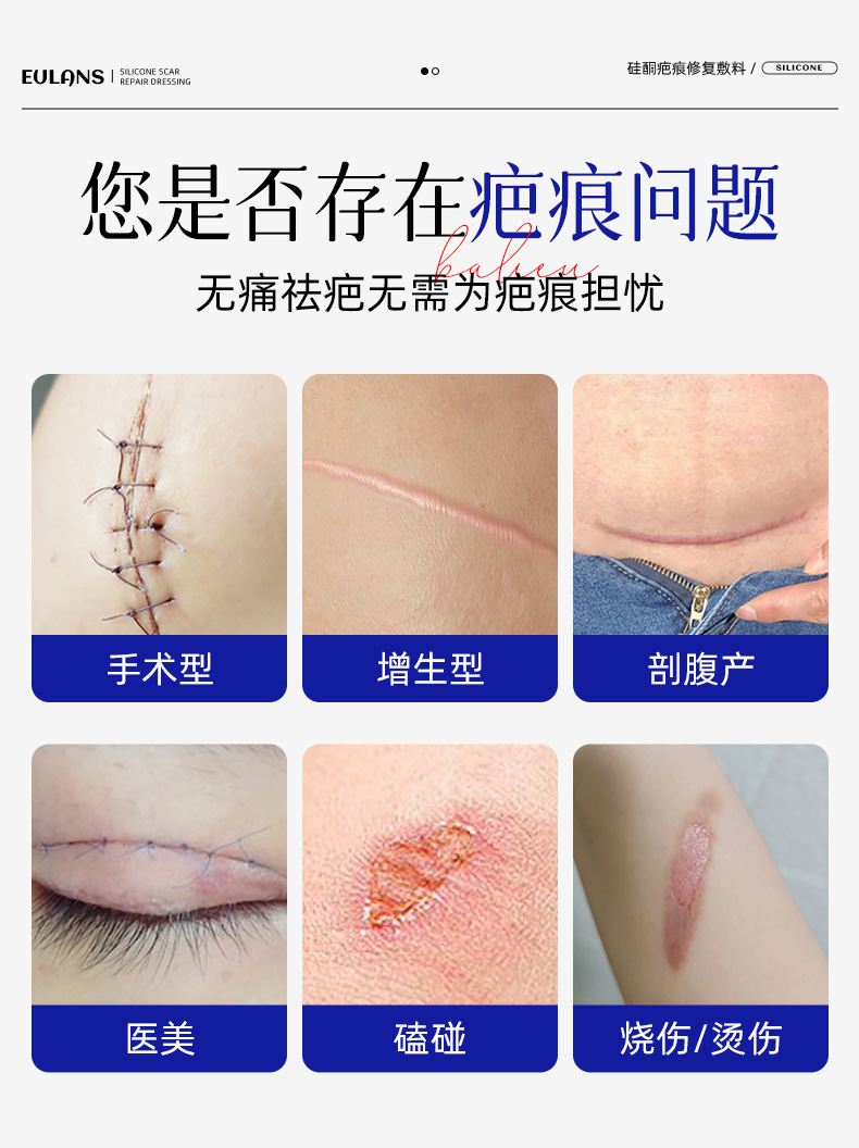 二类医疗器械疤痕膏淡化痘印烧烫伤剖腹产疤痕术后皮肤护理批发详情2