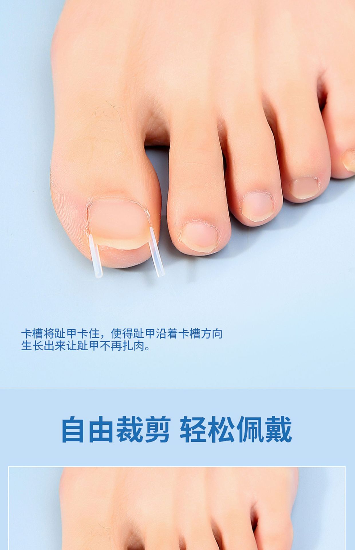 Nail groove corrector, a must-have tool for inflammation, nail straightening patch, nail patch, ingrown toenail, toenail growing into the flesh correction, filling and gasket pic 6