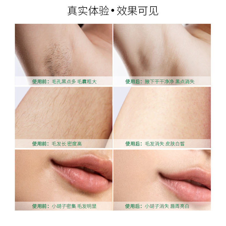 FDA manufacturer wholesale full-body skin rejuvenation beauty device, portable hair cleaning device, handheld photon skin rejuvenation 510K pic 13