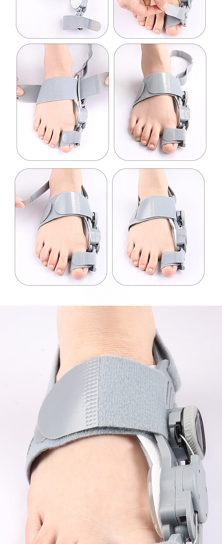 Thumb eversion orthosis, big foot bone protrusion overlapping toe separator, day and night adjustable knob orthosis pic 7