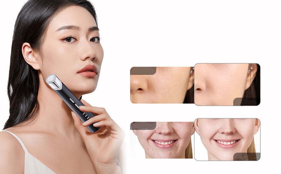 shanilak          新款美眼仪精华导入仪EMS嫩肤微电流导入仪眼部按摩仪护肤详情3