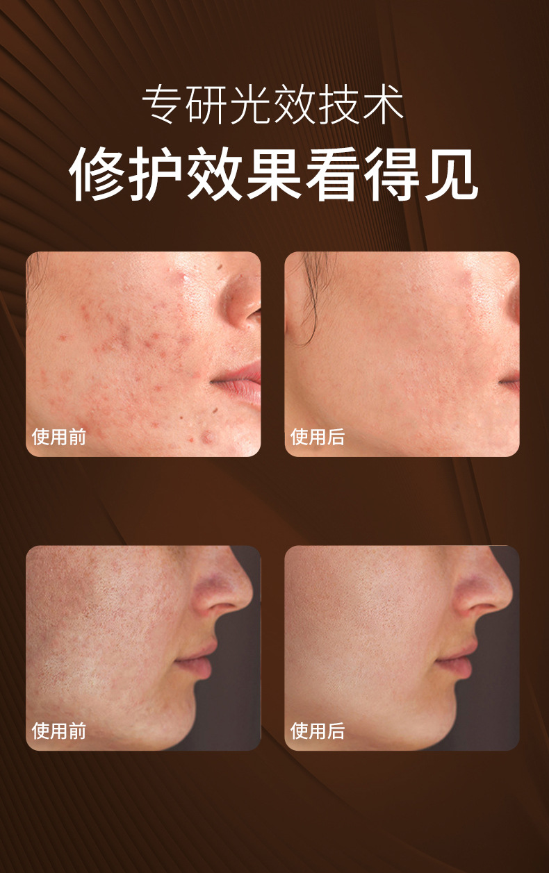 shanilak  美容仪大熨斗家用面部导入仪光子嫩肤脸部眼部提拉紧致黄金胶原蛋详情17