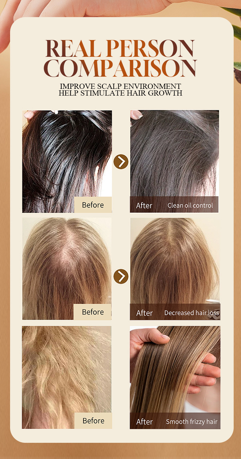 【 Cross-border Exclusive Supply 】FORMBO Hair Essential Oil Softens hair strands with luster and improves frizz. Wholesale of Hair essential oil pic 11
