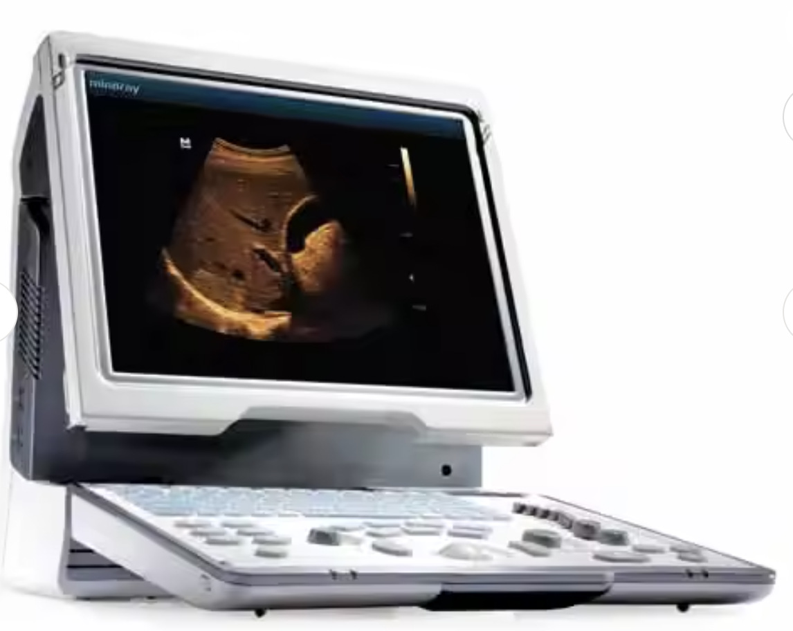 Mindray DP50 ultrasonic scanner, a color portable ultrasonic scanner, is a portable ultrasonic diagnostic system pic 7