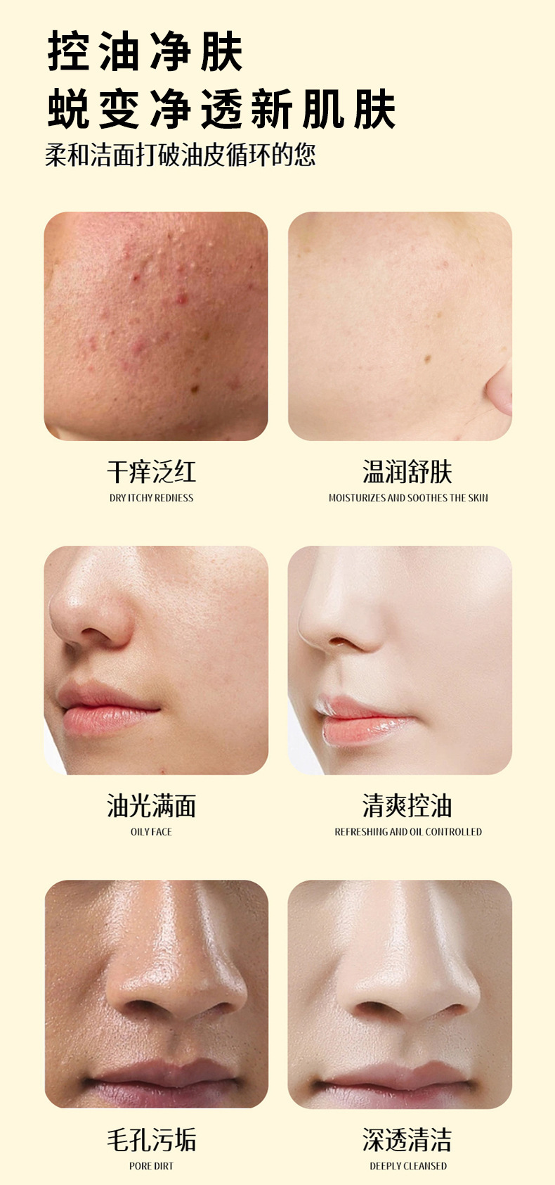 硫磺洗面奶深层清洁面乳皂倾颜收缩毛孔黑头控油男女士正品详情9