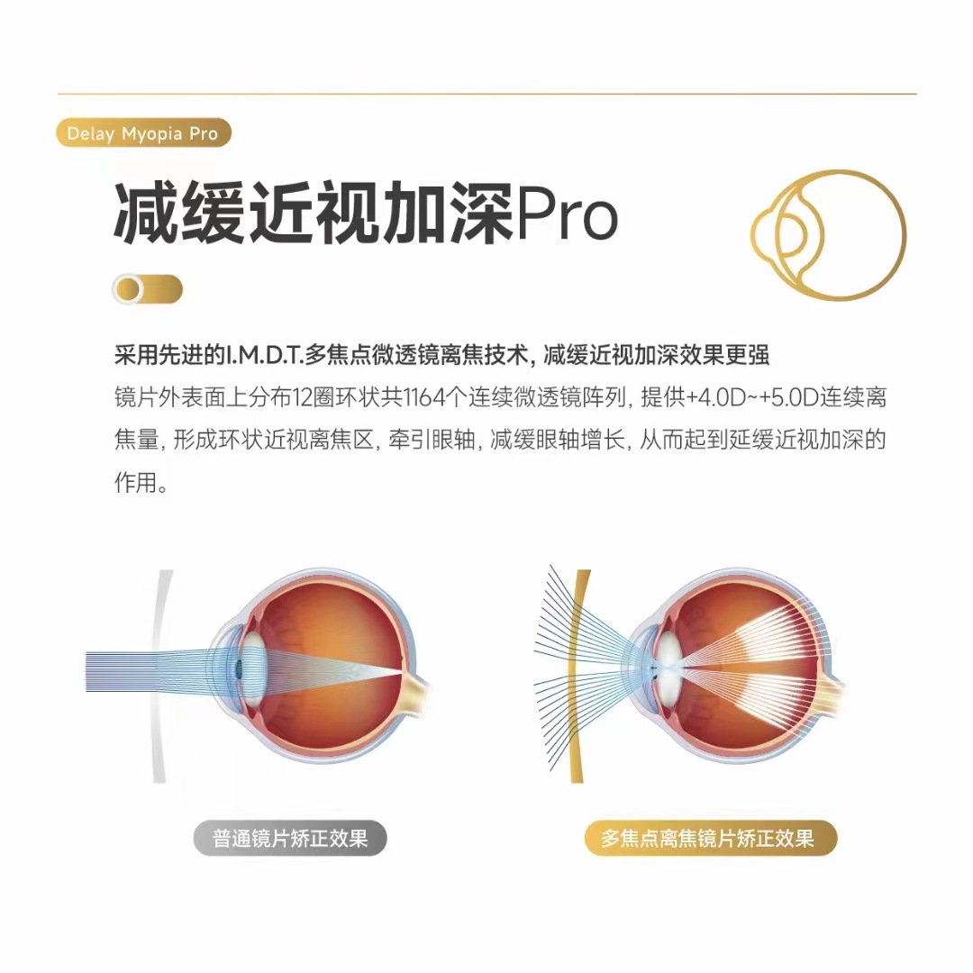 SA优立MR-8星视力1598PRO智能多焦点离焦镜片详情3