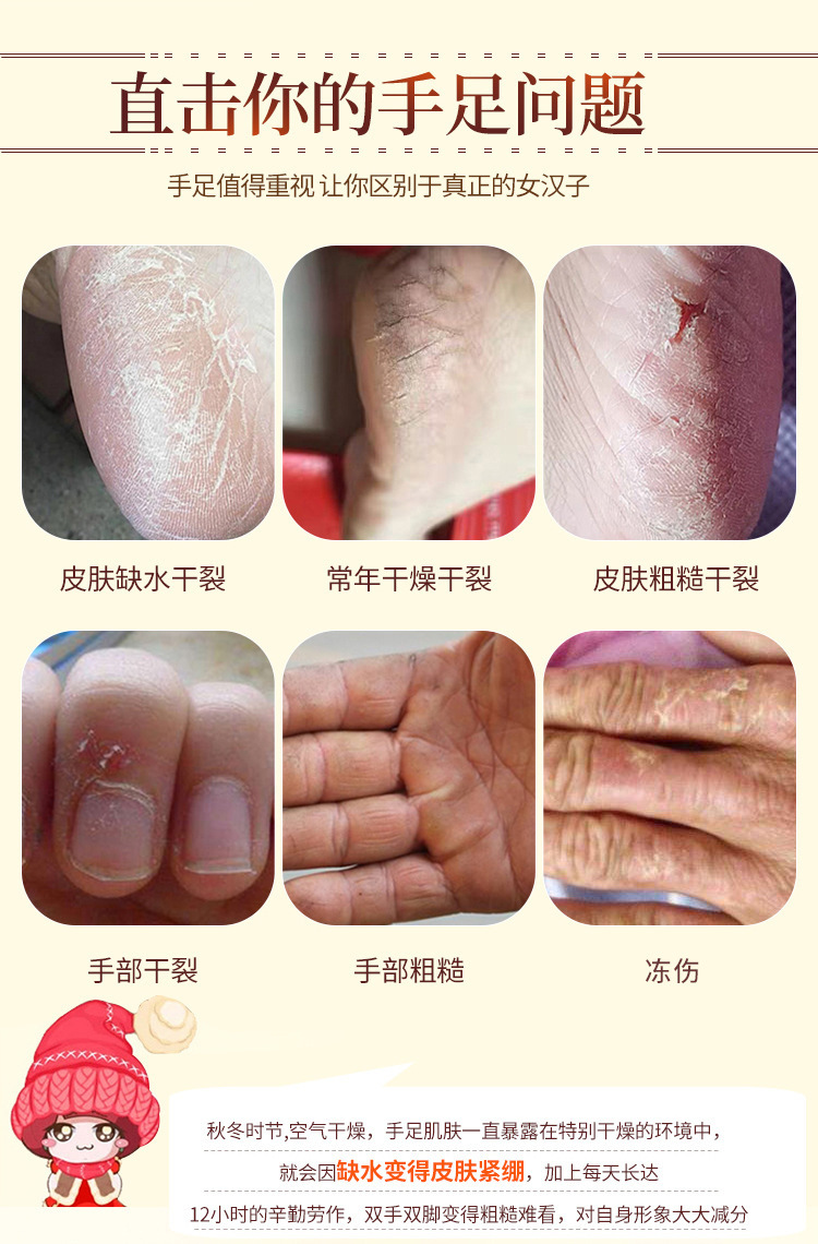 马油防冻防裂霜补水保湿修护手足干燥脱皮秋冬季嫩肤护手霜批发