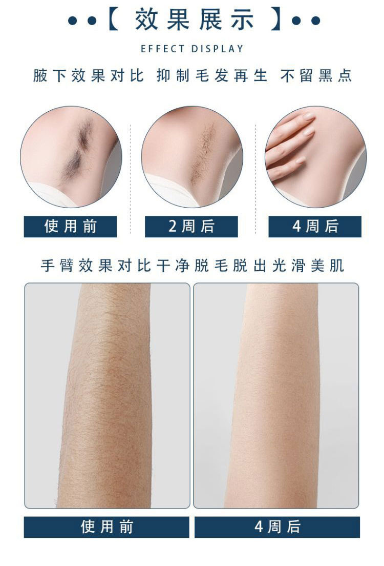 shanilak export handheld Ice Point Hair Removal Device, full-body hair removal and shaving device, Private ipl Ice Point Hair Removal device wholesale pic 12