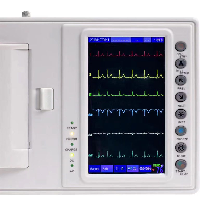 Cross-border exclusive supply ECG-1206A ECG machine, 6-channel portable fully automatic analytical ECG detector for human use pic 8