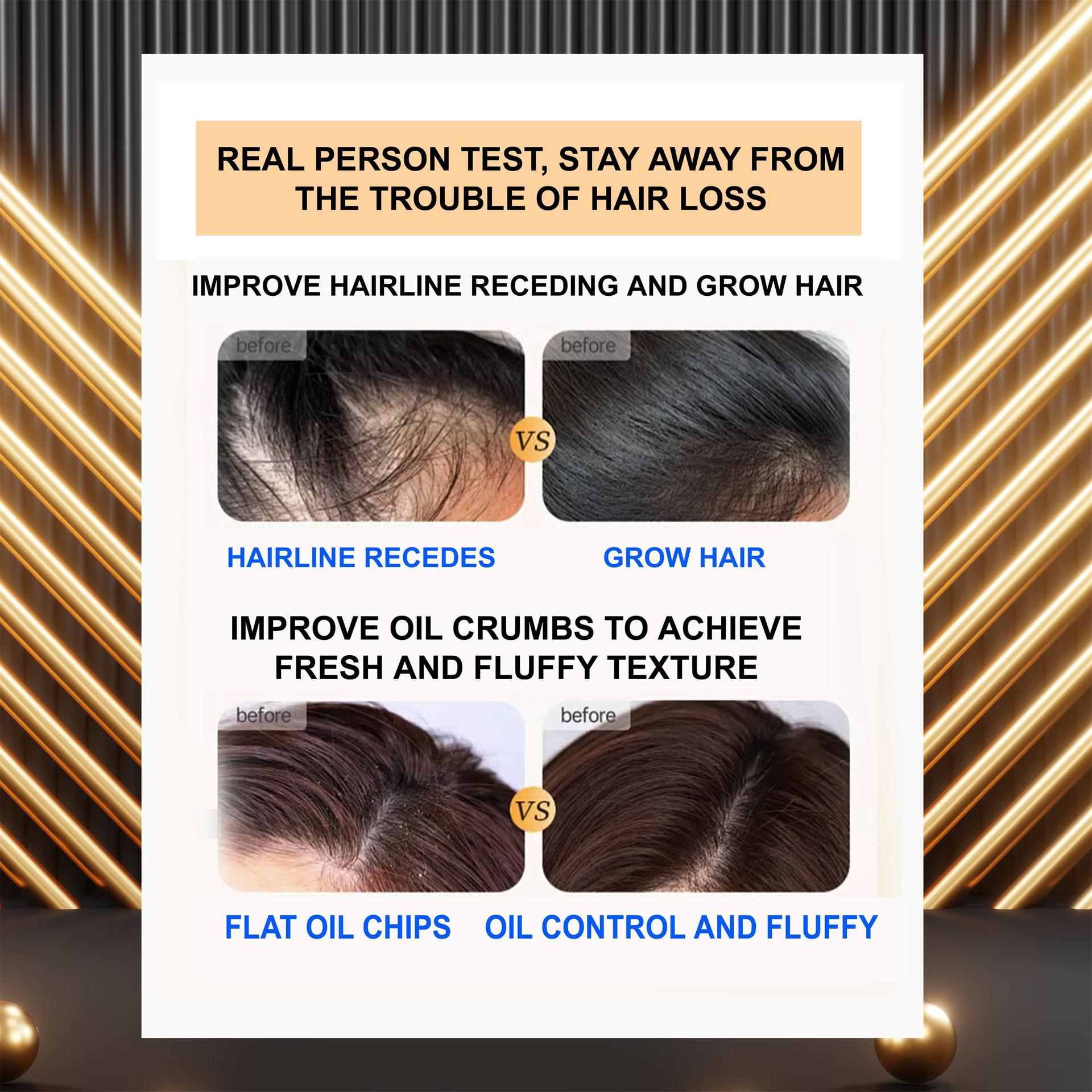 Anti-hair loss shampoo Anti-dandruff shampoo Deep Cleansing pic 5