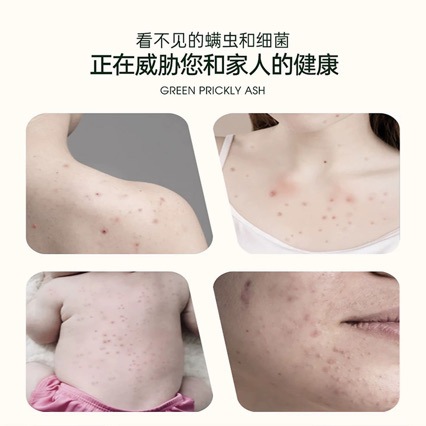 Linglexi Green Pepper Mite Repellent Spray, Bed and quilt household insecticide 蝻 agent, a no-rinse mite removal wonder pic 5
