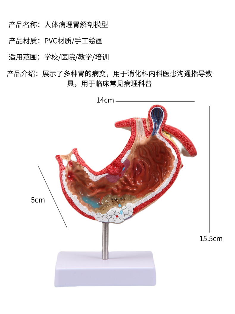 Human stomach anatomy model, traditional Chinese medicine teaching physical object, human stomach structure model, portable demonstration equipment, tuning fork to assist learning pic 4