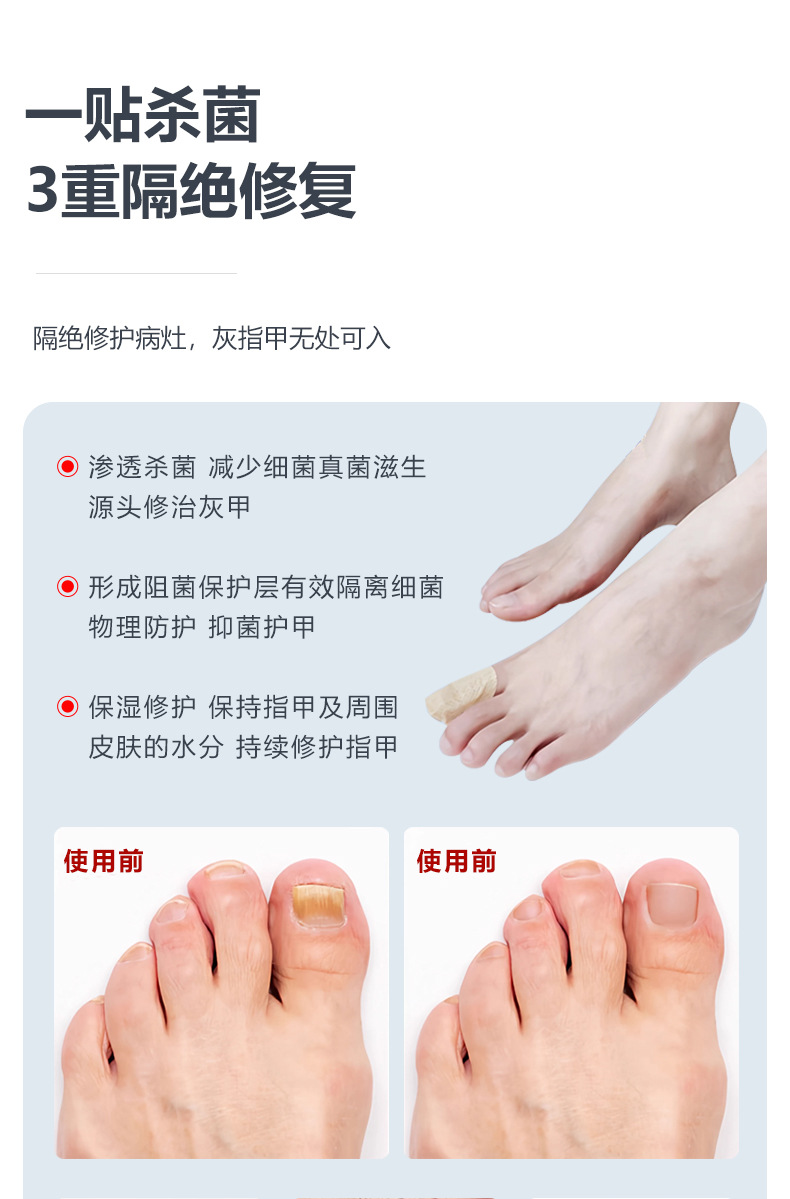 灰指甲贴保护脚趾甲遮丑贴片对抗细菌感染指甲足部护理手指防护贴详情6