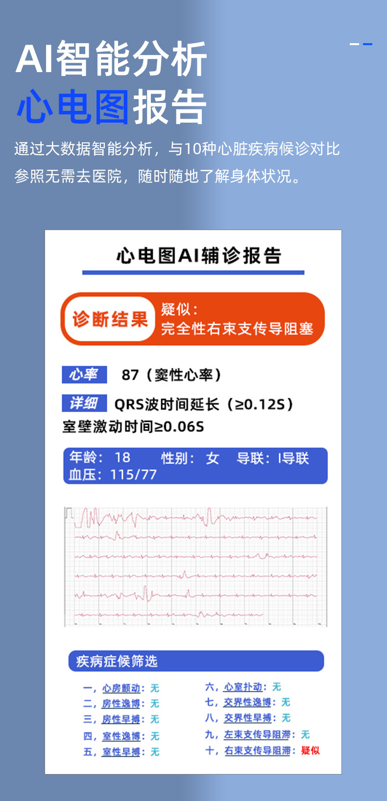 Cross-border ECG, electrocardiogram, non-invasive blood glucose measurement, blood pressure, blood oxygen, body temperature, electrocardiogram, sleep monitoring, KS03 smartwatch pic 9
