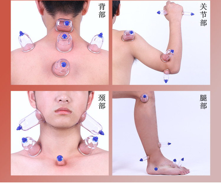 刺络放血罐真空拔罐器家用抽气式气罐心天排淤拔血罐泻血排瘀套装详情11