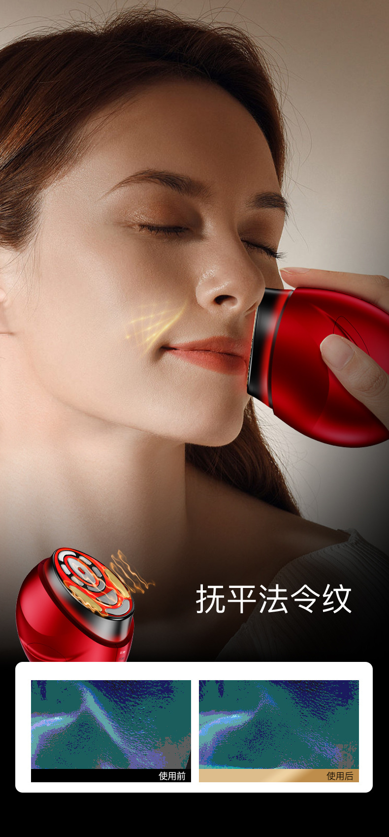 shanilak  美容仪大熨斗家用面部导入仪光子嫩肤脸部眼部提拉紧致黄金胶原蛋详情8